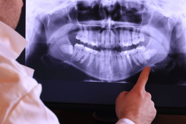Best Mobile Emergency Dentist in King, NC